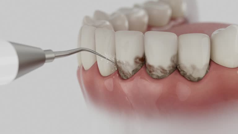 Reliable Dental contractor in Lake Waynoka, OH by Dentist Open Now